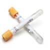 Buy BD SST II Advance Yellow Top 100Pack Vacutainer Tubes, Draw Volume: 8.5ml in Kenya
