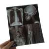 Buy Drystar Agfa 10 by 12inches Xray Film in Kenya
