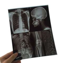 Buy Drystar Agfa 10 by 12inches Xray Film in Kenya