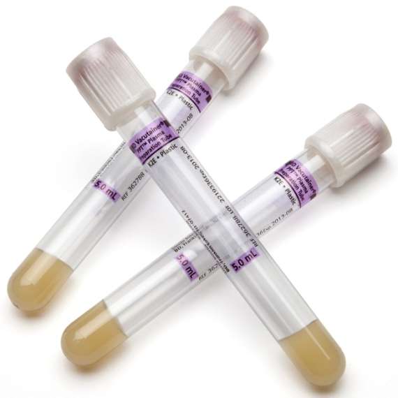 Buy BD 5ml K2 EDTA 100Pack Plasma Preparation Vacutainer Tubes in [storefront]