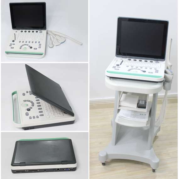 Buy Sonostar SS-8 Laptop Ultrasound Scanner in [storefront]