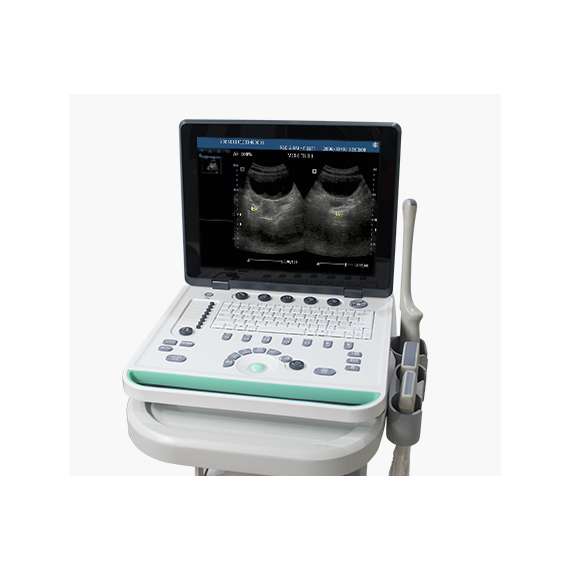 Buy Sonostar SS-8 Laptop Ultrasound Scanner in [storefront]