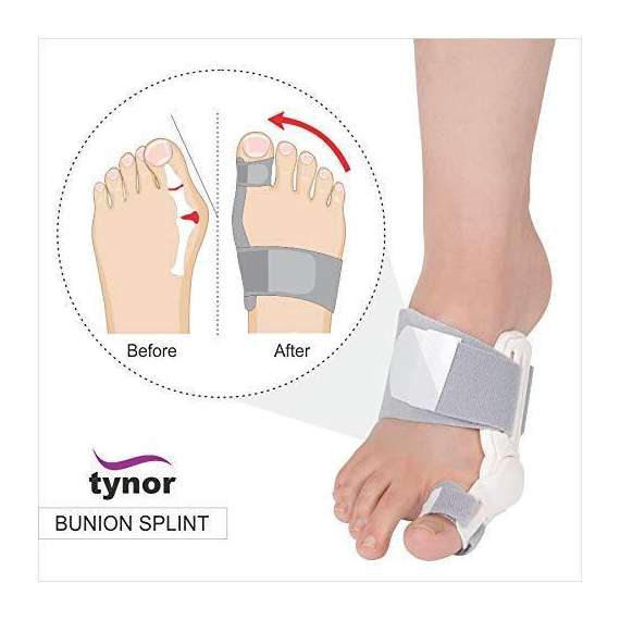 Buy Tynor One Piece Bunion Splint in [storefront]